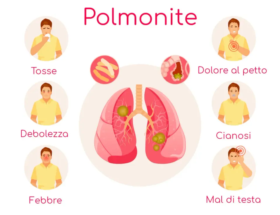 Polmonite ab ingestis nei bambini - sintomi e segnali d’allarme